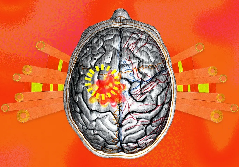 চরম গরমে মস্তিষ্কের জন্য বাড়ছে অদৃশ্য হুমকি